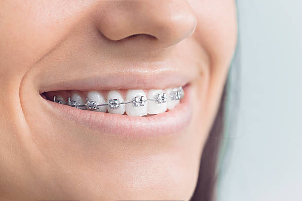 Best Traditional Braces  in Orland Park, IL